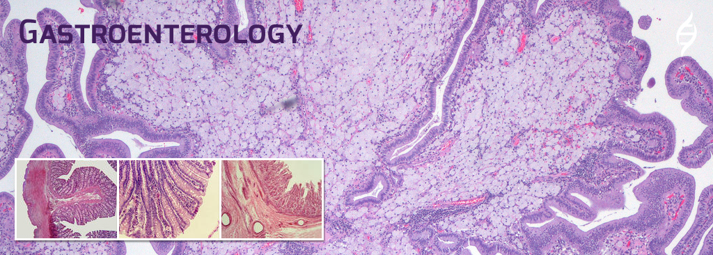 Gastroenterology Diagnostics