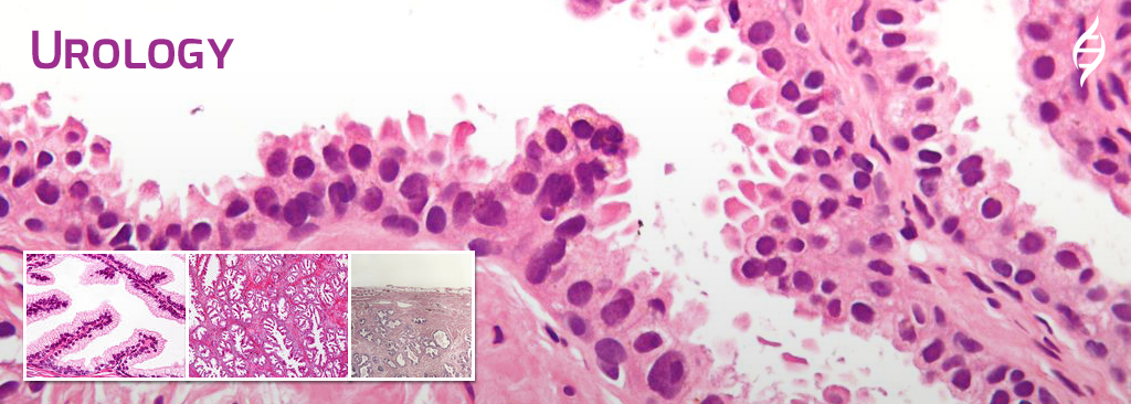 Urology Subspecialty